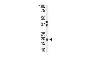 The anti-IL28 Ctr-term Pab (ABIN388445 and ABIN2848736) is used in Western blot to detect IL28 in mouse brain tissue lysate. (IL-28 Antikörper  (AA 61-92))