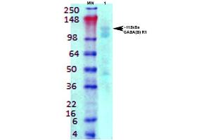 Western Blot analysis of Rat brain membrane lysate showing detection of GABA B Receptor 1 protein using Mouse Anti-GABA B Receptor 1 Monoclonal Antibody, Clone S93A-49 . (GABBR1 Antikörper  (AA 873-977) (Atto 390))