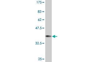 Western Blot detection against Immunogen (37. (HOXB1 Antikörper  (AA 101-210))