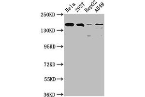 Western Blot Positive WB detected in: Hela whole cell lysate, 293T whole cell lysate, HepG2 whole cell lysate, A549 whole cell lysate All lanes: BRD4 antibody at 1:1500 Secondary Goat polyclonal to rabbit IgG at 1/50000 dilution Predicted band size: 153, 81, 89 kDa Observed band size: 153 kDa (Rekombinanter BRD4 Antikörper)