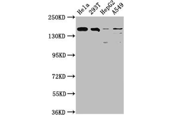 Recombinant BRD4 antibody