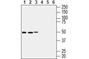 Western blot analysis of human Burkitt's lymphoma Daudi (lanes 1 and 3), human T-cell leukemia Jurkat (lanes 2 and 5) and human breast adenocarcinoma MCF-7 cell lysates (lanes 3 and 6): - 1-3. (Septin 7 Antikörper  (Intracellular))