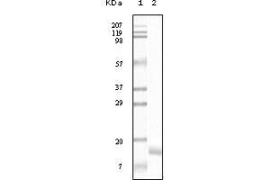 Western Blotting (WB) image for anti-Synuclein, gamma (Breast Cancer-Specific Protein 1) (SNCG) (truncated) antibody (ABIN2464104) (SNCG Antikörper  (truncated))