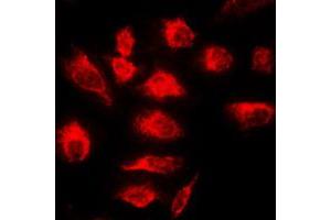 Immunofluorescent analysis of A20 staining in HeLa cells. (IGKV1-27 Antikörper  (Center))