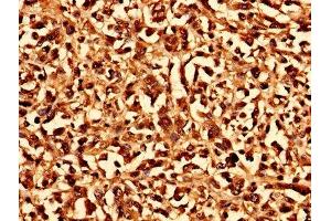 Immunohistochemistry (IHC) image for anti-Charged Multivesicular Body Protein 6 (CHMP6) (AA 2-201) antibody (ABIN7147533)