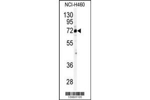 Western blot analysis of anti-CSTF2 Antibody (N-term) (ABIN388655 and ABIN2838407) in NCI- cell line lysates (35 μg/lane). (CSTF2 Antikörper  (N-Term))