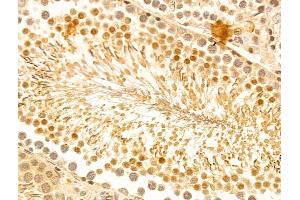 ABIN7094244 and ABIN7098291 at 1/100 staining Rat testis tissue by IHC-P. (FZR1 Antikörper  (Internal Region))