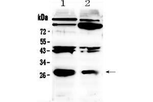 Western blot analysis of PDGF beta using anti- PDGF beta antibody .