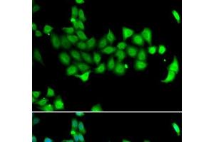 Immunofluorescence analysis of A549 cells using HSPA14 Polyclonal Antibody (HSPA14 Antikörper)