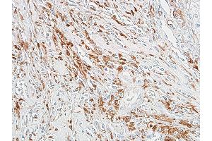 Immunohistochemistry (IHC) image for anti-Aldehyde Dehydrogenase 1 Family, Member A1 (ALDH1A1) (AA 300-350) antibody (ABIN7453956)