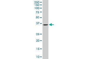 SH3GL2 monoclonal antibody (M06), clone 2G6. (SH3G2 Antikörper  (AA 64-124))