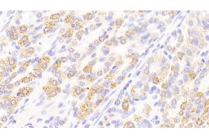 Detection of REG3a in Human Stomach Tissue using Polyclonal Antibody to Regenerating Islet Derived Protein 3 Alpha (REG3a) (REG3A Antikörper  (AA 40-164))