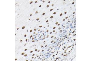 Immunohistochemistry of paraffin-embedded human esophageal using Histone H1t Rabbit pAb (ABIN7267716) at dilution of 1:100 (40x lens). (Histone H1 Antikörper  (AA 150-207))