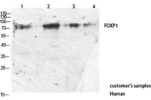 Western Blotting (WB) image for anti-Forkhead Box P1 (FOXP1) (C-Term) antibody (ABIN3187748)