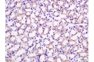 Formalin-fixed and paraffin embedded mouse kidney tissue labeled with Rabbit Anti-Nocturnin Polyclonal Antibody, Unconjugated  at 1:200 followed by conjugation to the secondary antibody and DAB staining (CCRN4L Antikörper  (AA 231-330))