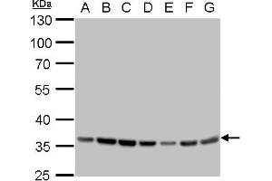 Western Blotting (WB) image for anti-Glyceraldehyde-3-Phosphate Dehydrogenase (GAPDH) antibody (ABIN2857072)