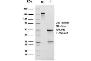 SDS-PAGE (SDS) image for anti-Integrin alpha M (ITGAM) (AA 941-1074) antibody (ABIN6939813)