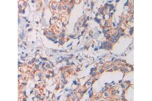 IHC-P analysis of Kidney tissue, with DAB staining. (KEL Antikörper  (AA 128-332))