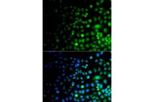 Immunofluorescence analysis of A549 cells using UBA6 antibody (ABIN5975585). (UBA6 Antikörper)