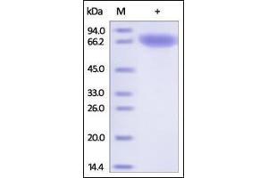 SDS-PAGE (SDS) image for Transferrin Receptor (p90, CD71) (TFRC) (AA 89-760) (Active) protein (His tag) (ABIN2180829)