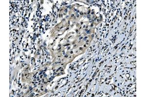 IHC analysis of CDC27 using anti-CDC27 antibody (ABIN7602163). (CDC27 Antikörper  (AA 609-824))