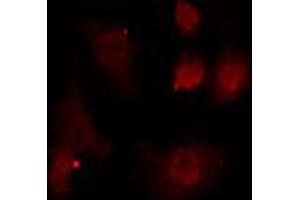 ABIN6274698 staining HeLa cells by IF/ICC. (PMS2 Antikörper  (C-Term))
