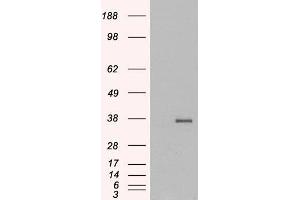 Western Blotting (WB) image for anti-Growth Differentiation Factor 15 (GDF15) (C-Term) antibody (ABIN185465)