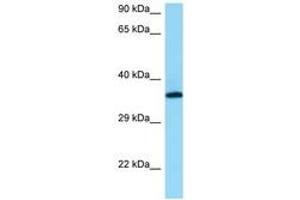 Image no. 1 for anti-Retinal G Protein Coupled Receptor (RGR) (AA 76-125) antibody (ABIN6748402) (RGR Antikörper  (AA 76-125))