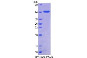 SDS-PAGE (SDS) image for Small Ubiquitin Related Modifier 2 (SUMO2) (AA 1-95) protein (His tag,GST tag) (ABIN6237148) (SUMO2 Protein (AA 1-95) (His tag,GST tag))