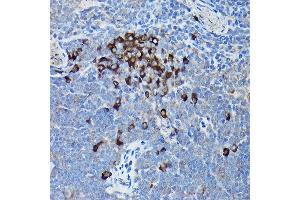 Immunohistochemistry of paraffin-embedded mouse spleen using DDIT3/CHOP Rabbit pAb (ABIN6131562, ABIN6139460, ABIN6139463 and ABIN6215170) at dilution of 1:200 (40x lens). (DDIT3 Antikörper  (AA 1-169))