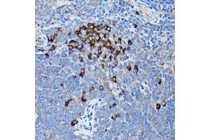 Immunohistochemistry of paraffin-embedded mouse spleen using DDIT3/CHOP Rabbit pAb (ABIN6131562, ABIN6139460, ABIN6139463 and ABIN6215170) at dilution of 1:200 (40x lens).