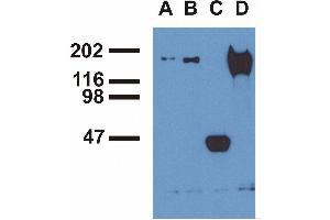 Immunoprecipitation ofEGFR from EGF-treated A431 cells byphosphospecific monoclonal antibodies (A), EM-13 (B), a commercial anti-EGFR polyclonal antibody(C) and anti-EGFR monoclonal mAb108 (D). (EGFR Antikörper  (Tyr992))