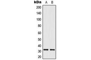 Western blot analysis of ELOVL1 expression in HeLa (A), HepG2 (B) whole cell lysates. (ELOVL1 Antikörper  (Center))