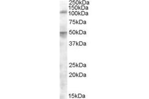 Western Blotting (WB) image for anti-Endoplasmic Reticulum Aminopeptidase 2 (ERAP2) (AA 480-493) antibody (ABIN343047) (ERAP2 Antikörper  (AA 480-493))