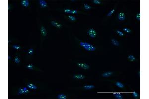 Immunofluorescence of purified MaxPab antibody to PES1 on HeLa cell. (PES1 Antikörper  (AA 1-588))