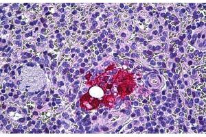 Human Spleen, Macrophages: Formalin-Fixed, Paraffin-Embedded (FFPE) (Galectin 3 Antikörper  (AA 141-190))