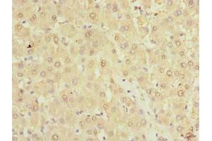 Immunohistochemistry of paraffin-embedded human liver tissue using ABIN7173011 at dilution of 1:100 (TMPRSS6 Antikörper  (AA 98-301))