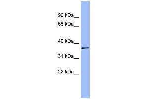 WB Suggested Anti-HAPLN1 Antibody Titration:  0. (HAPLN1 Antikörper  (N-Term))