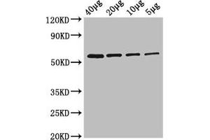 Western Blot Positive WB detected in: Rosseta bacteria lysate at 40 μg, 20 μg, 10 μg, 5 μg All lanes: glpK antibody at 2.