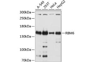 Western blot analysis of extracts of various cell lines, using RBM6 antibody (ABIN6129739, ABIN6146788, ABIN6146789 and ABIN6214632) at 1:2000 dilution. (RBM6 Antikörper  (AA 530-770))