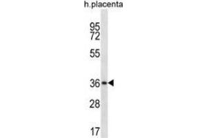 Western blot analysis in human placenta tissue lysates (35ug/lane) using MUL1 / RNF218 Antibody (C-term). (MUL1 Antikörper  (C-Term))