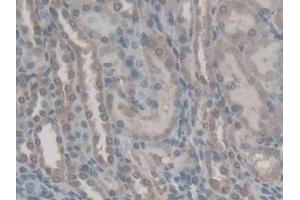 IHC-P analysis of Rat Kidney Tissue, with DAB staining. (Retinol Binding Protein 5 Antikörper  (AA 19-201))