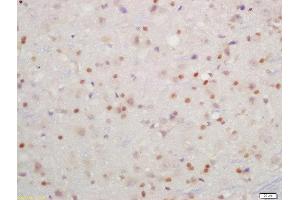 Formalin-fixed and paraffin embedded rat brain labeled with Rabbit Anti-IKK beta(Tyr199) Polyclonal Antibody, Unconjugated  at 1:200 followed by conjugation to the secondary antibody and DAB staining (IKBKB Antikörper  (pTyr199))
