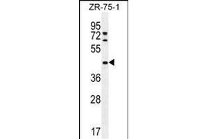 METTL2 Antibody (C-term) (ABIN655892 and ABIN2845293) western blot analysis in ZR-75-1 cell line lysates (35 μg/lane). (METTL2 Antikörper  (C-Term))