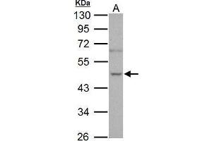 WB Image Sample (30 ug of whole cell lysate) A: PC-3 10% SDS PAGE antibody diluted at 1:1000 (NOVA1 Antikörper  (C-Term))