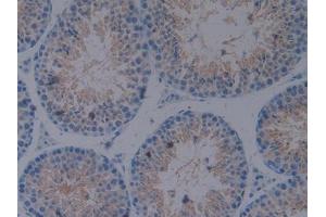 IHC-P analysis of Mouse Testis Tissue, with DAB staining. (CX3CL1 Antikörper  (AA 83-330))