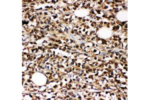 Anti-CD10 Picoband antibody,  IHC(P): Human B lymphocyte Cancer Tissue