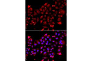 Immunofluorescence analysis of A549 cell using RRM2B antibody. (RRM2B Antikörper)