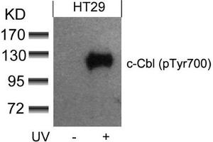 Western blot analysis of extracts from HT29 cells untreated or treated with UV using c-Cbl(phospho-Tyr700) Antibody. (CBL Antikörper  (pTyr770))