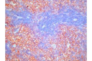 Immunohistochemistry (IHC) image for anti-Complement Component (3b/4b) Receptor 1-Like (CR1L) antibody (ABIN781721) (CR1L Antikörper)